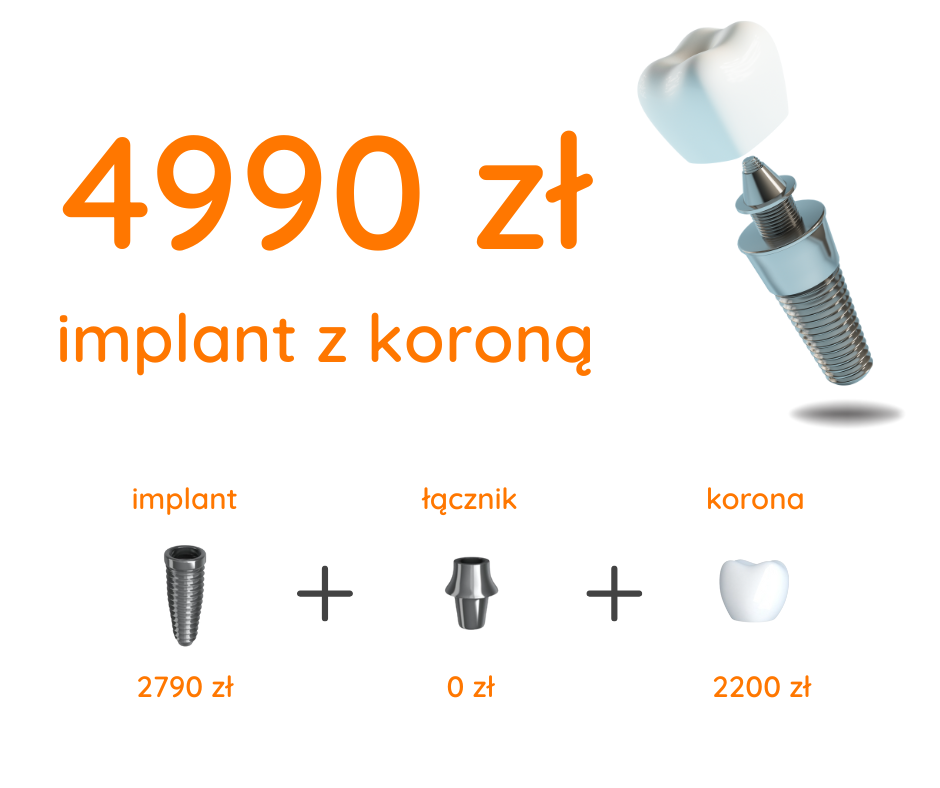 PROMOCJA IMPLANTY